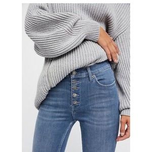 Free People • Reagan Exposed Button Fly Crop Jeans
